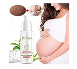 Powerful To Stretch Marks Cream Maternity Skin Care Treatment Cream For Stretch Mark Remover Obesity Postpartum Repair